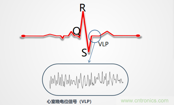解決心電監(jiān)測(cè)行業(yè)難題，曼森伯格的濾波技術(shù)獲國(guó)家知識(shí)產(chǎn)權(quán)局發(fā)明授權(quán)